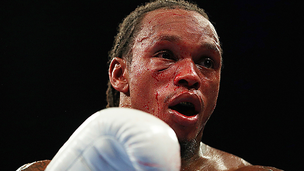 "I will be the complete fighter," says a defiant Anthony Yarde